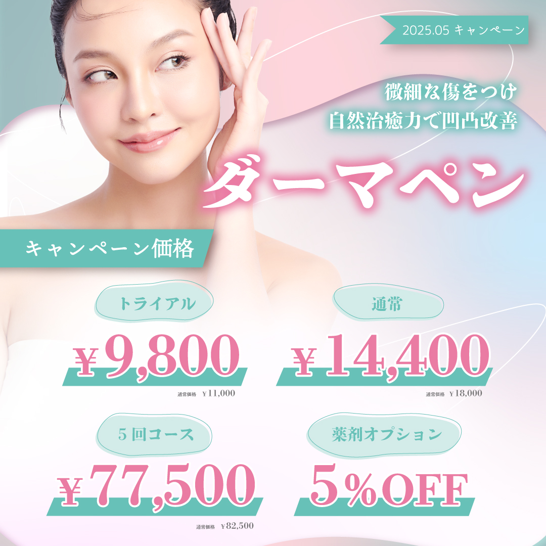 5月キャンペーン 