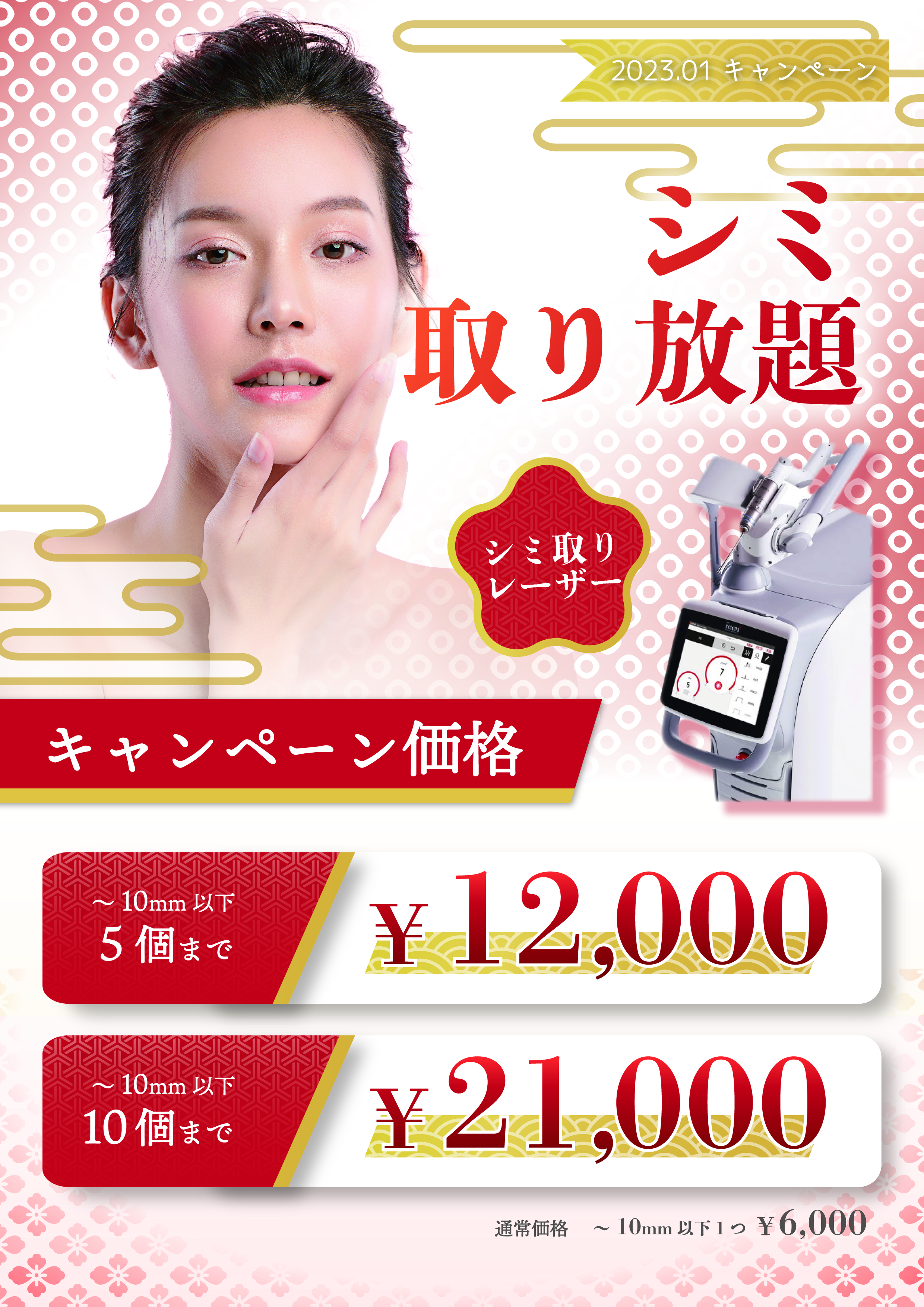 シミ取り放題キャンペーン
