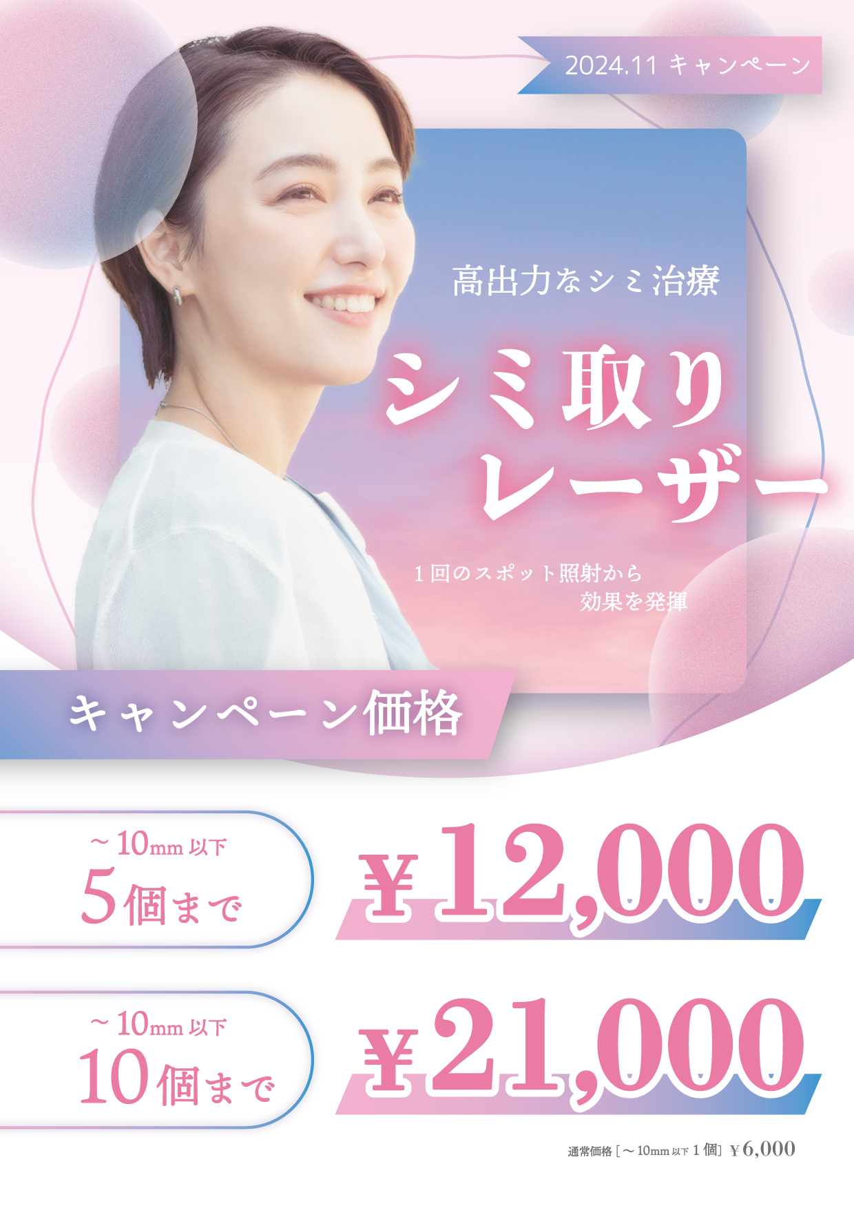 シミ取りレーザーキャンペーン