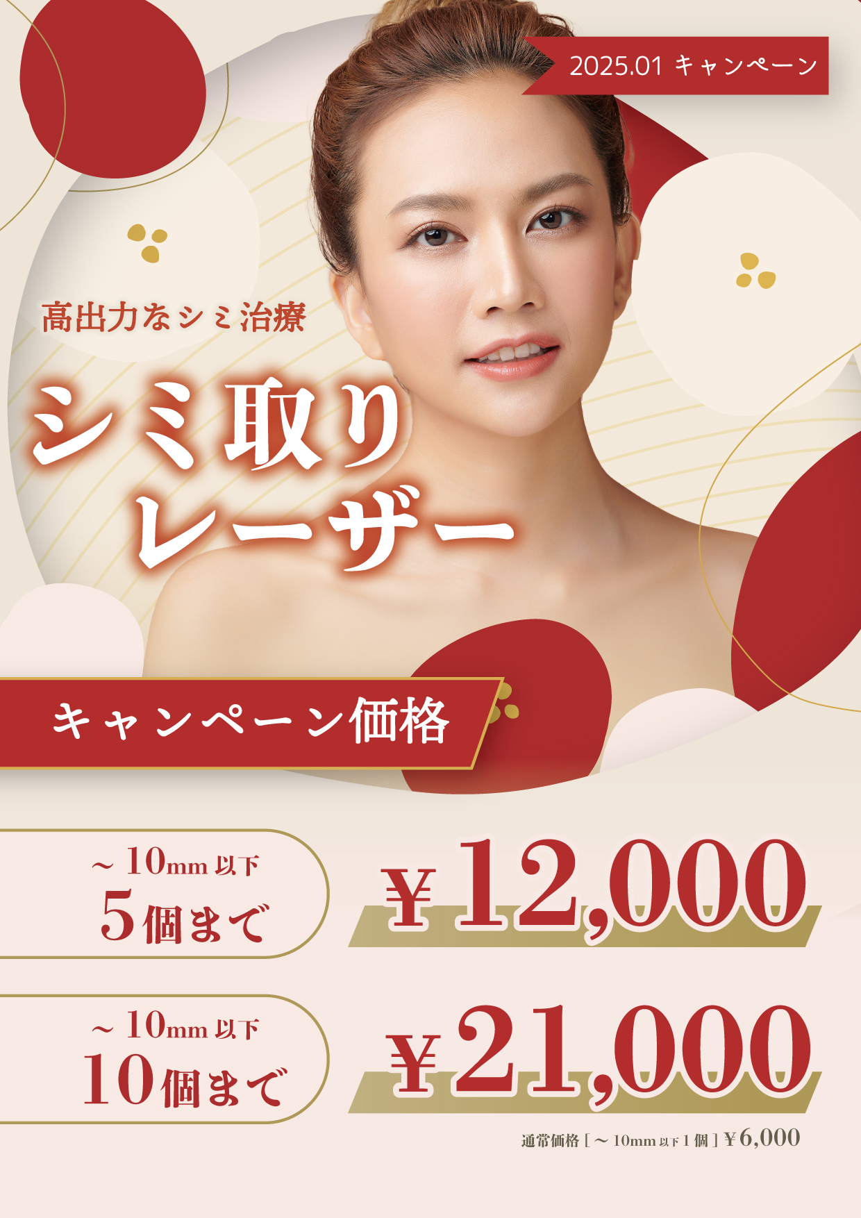 シミ取りレーザーキャンペーン