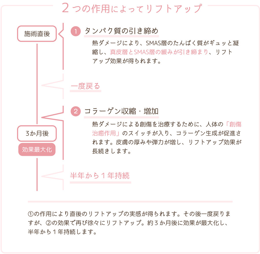 2つの作用によってリフトアップ