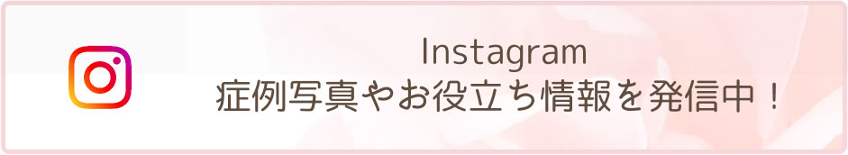 インスタグラム