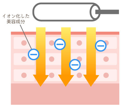 イオン導入