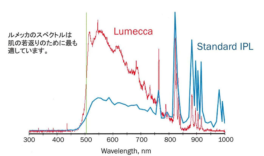 これまでのIPLとの違い