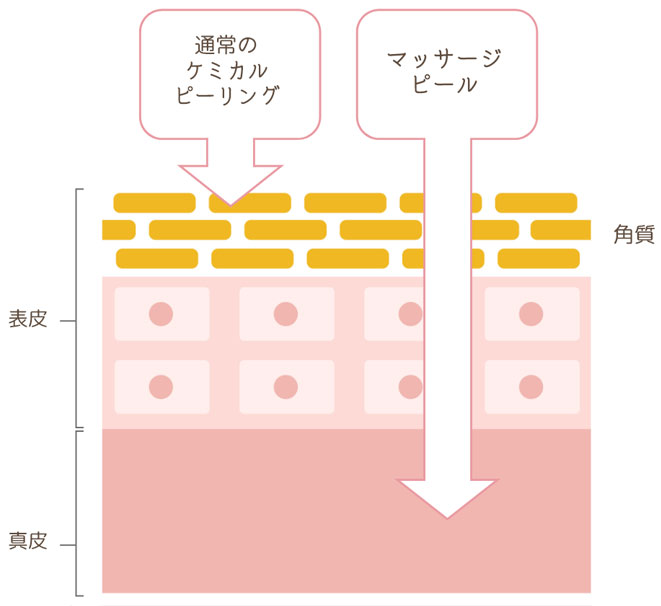 ケミカルピーリングとの違い