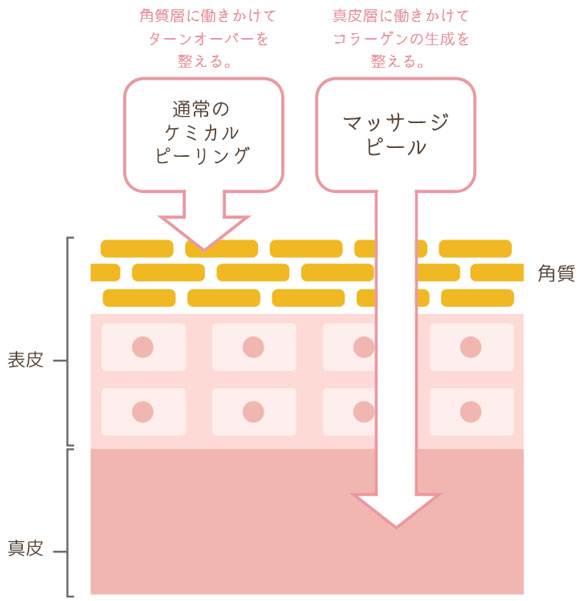 ケミカルピーリングとの違い