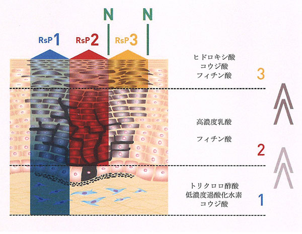 リバースピールの特徴